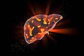 Liver disease, conceptual illustration