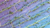Canadian pondweed, light microscopy