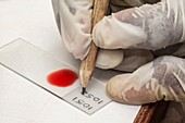 Labelling a blood sample