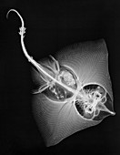 Thornback ray, X-ray