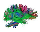 Brain fibres side view right, DTI scan