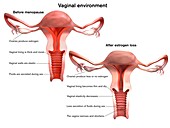 Menopause vaginal effects, illustration