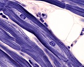 Myocardium muscle cells, light micrograph