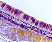 Layers of trachea wall, light micrograph