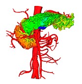 Pancreas and aorta, 3D CT scan