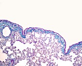 Pleural surface of the lung, light micrograph