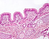 Bronchus wall, light micrograph