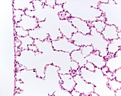 Lung alveoli, light micrograph