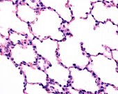 Lung alveoli, light micrograph