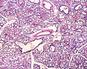 Pulmonary alveoli. Elastic fibres, light micrograph