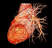 Human heart, 3D CT angiogram