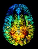 Human brain, 3D MRI scan