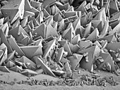 Kidney stone surface, SEM