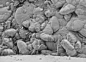 Kidney stone surface, SEM