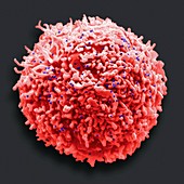T-cell infected with HIV, SEM