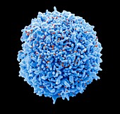 T-cell infected with HIV, SEM