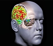 Human brain's right hemisphere, fMRI scan