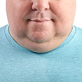 Overweight man's chin and neck