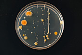 Cultures growing on Petri dish