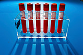 Blood samples in a lab