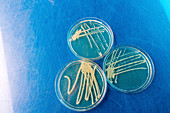 Cultures growing on Petri dish