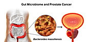 Gut microbiome and prostate cancer, conceptual illustration