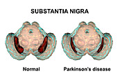 Substantia nigra and dopaminergic neurons, illustration