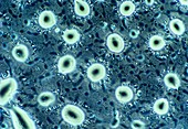 LM of cigarette smoke condensate