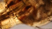Dipteran larva, light microscopy footage