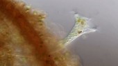 Stentor protozoan, light microscopy footage