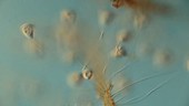 Vorticella campanula protozoa, light microscopy