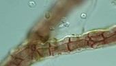 Vorticella ciliates on red algae, light microscopy