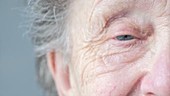Elderly woman's eye