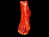 Human ankle and foot soft tissue, rotating 3D CT scan