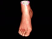 Human ankle and foot, rotating 3D CT scan
