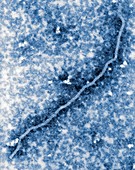 Nipah virus nucleocapsid, TEM