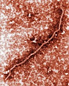 Nipah virus nucleocapsid, TEM
