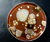 Microbes growing on agar plate