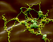 Lyme disease bacteria, Borrelia