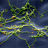 Lyme disease bacteria, Borrelia