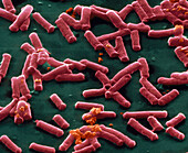 SEM of clostridium perfringens bacteria