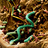Spirochaete bacterium in compost