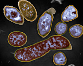 Vibrio cholerae 22000xTEM - Cholera