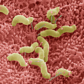 SEM of Helicobacter pylori bacteria