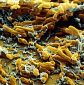 Mycobakt tuberkul 15000x - Tuberkulose-Bakterien
