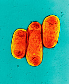 Plague bacteria, Yersinia pestis, TEM