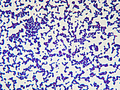 Staphyloc aureus 600x - Staphylococcus aureus 600x