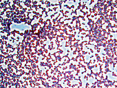 Staphyloc aureus PH 600x - Staphylococcus aureus 600x