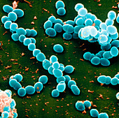 Enterococcus faecalis bacteria