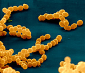 Chains of Streptococcus pyogenes bacteria